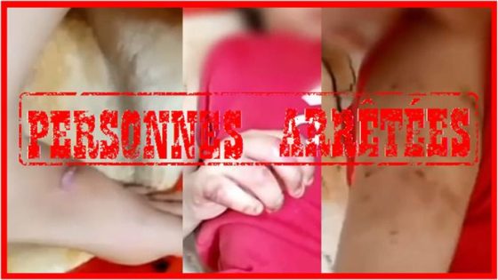 طفلة ضحية عنف وصور صادمة تستنفر أمن الدار البيضاء وتؤدي لتوقيف الأم وشريكها